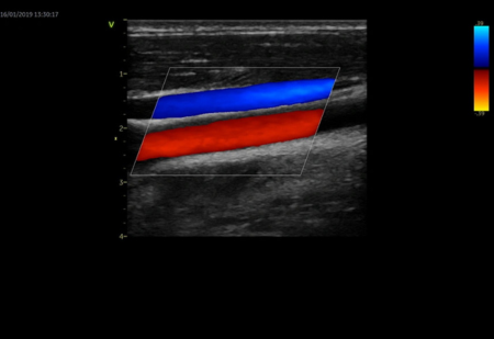 Ультразвуковая система Vivid Т8