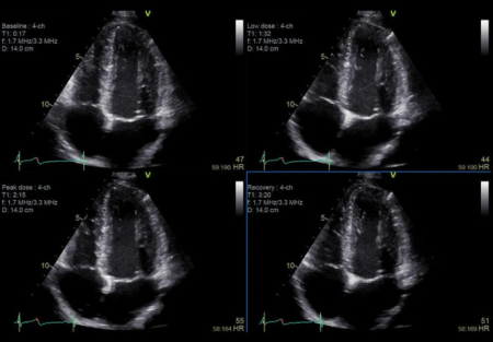 Ультразвуковая система Vivid S70