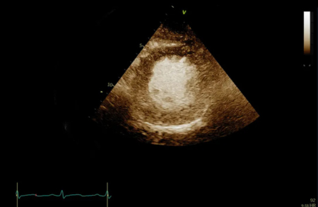 Ультразвуковая система Vivid Т8