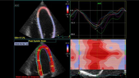 Ультразвуковая система Logiq P9
