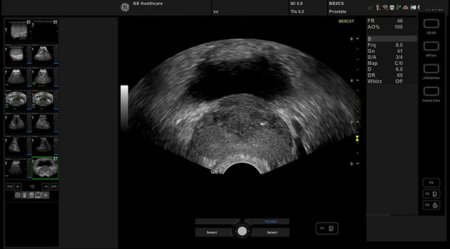 Ультразвуковая система Versana Premier 