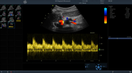 Ультразвуковая система Vivid Т8