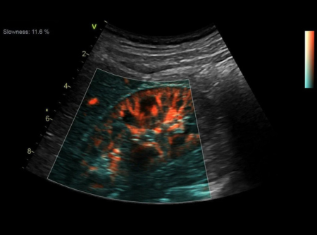 Ультразвуковая система Vivid S70