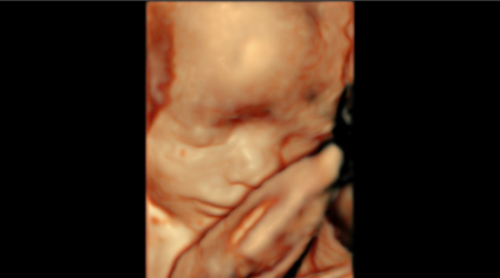 Ультразвуковая система Logiq P9