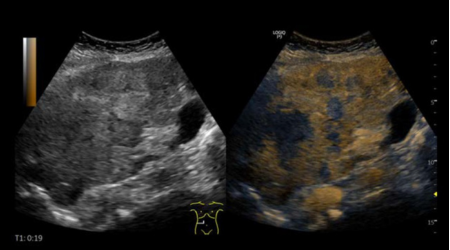 Ультразвуковая система Logiq P9