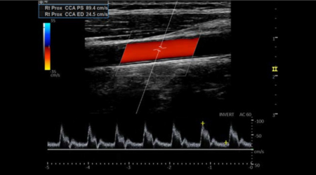 Ультразвуковая система Logiq P9