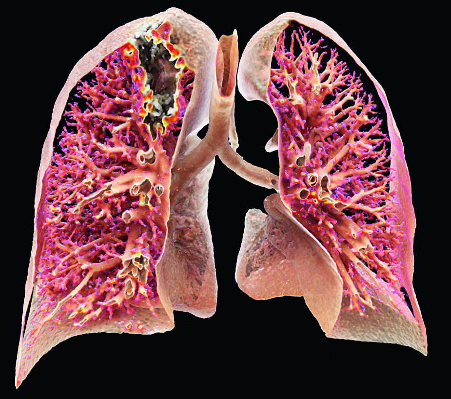 Page_23_Lung_processed_77.jpg