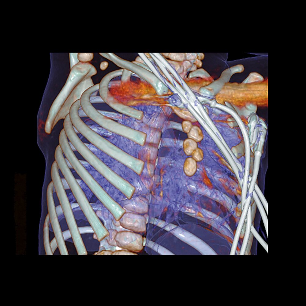 pediatrics-thorax-1.jpg