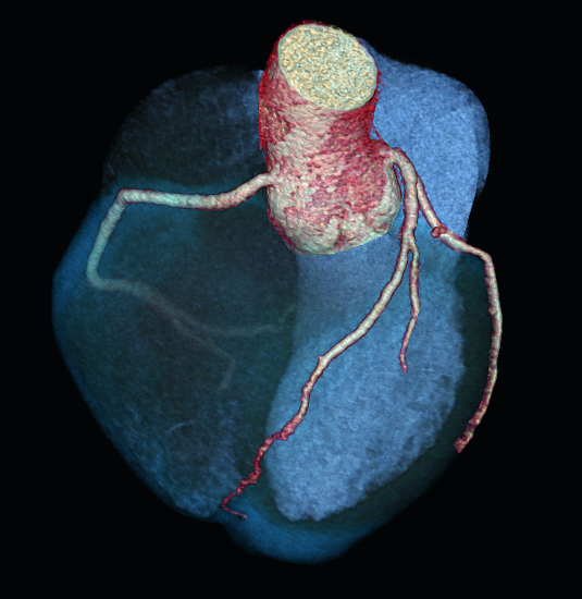 Page_27_Cardiovascular_Imaging_processed_167.jpg